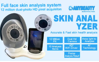 12 millones de analizadores portátiles 32G del cuidado de piel del análisis de la piel del pixel
