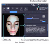Analizador portátil inteligente 160G del cuidado de piel de la imagen 1024*1280 del AI